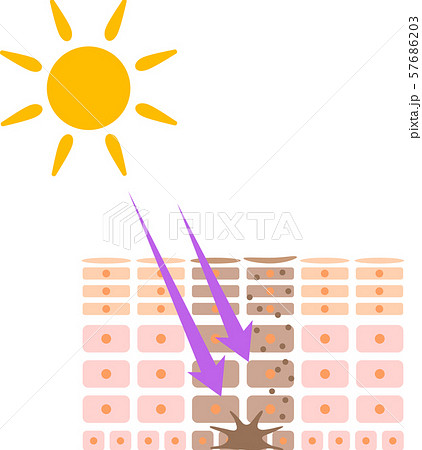 紫外線とメラニン発生の図解のイラスト素材