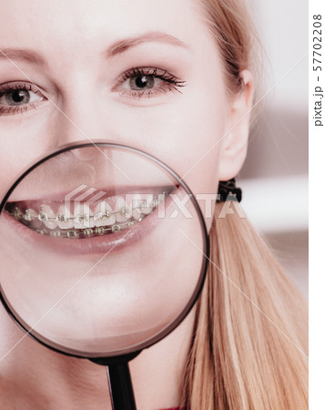 Happy woman showing her braces in magnifying glass 57702208