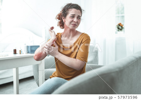 Curly mature woman having reddening after allergy to chemicals Curly mature woman having reddening after allergy to chemicals 57973596
