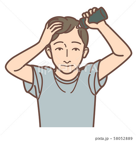 育毛剤塗布男性　進行度2 58052889
