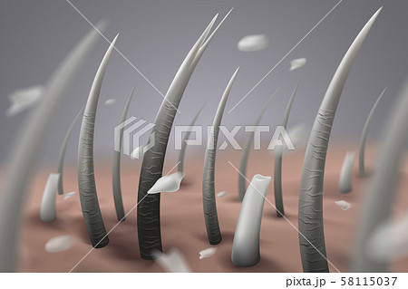 Damaged and gray hair The scalp has dandruff. Vector realistic file. 58115037