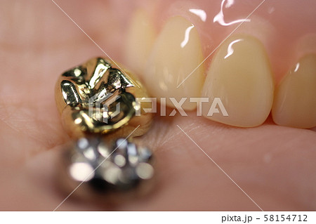 歯 58154712