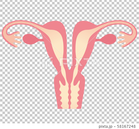 子宮畸形子宮重複 子宮畸形子宮重複 58167248