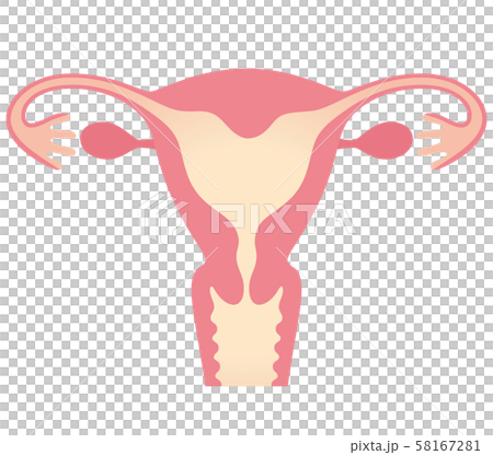 子宮畸形弓狀子宮 子宮畸形弓狀子宮 58167281