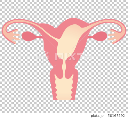 子宮畸形 子宮畸形 58167292