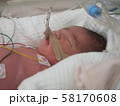 NICUで呼吸器をつけた赤ちゃん 58170608