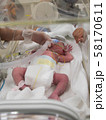 NICUの赤ちゃん　仰向け 58170611