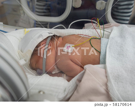 NICU　赤ちゃん　呼吸器　うつ伏せ 58170614
