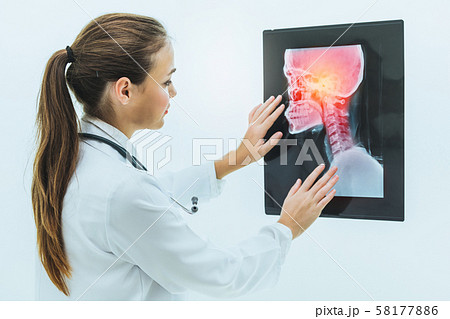 Doctor working with x ray film of patient head. 58177886