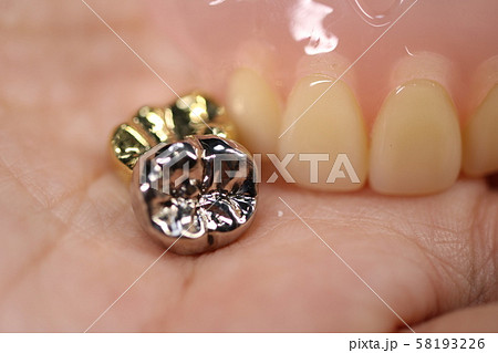 歯 58193226