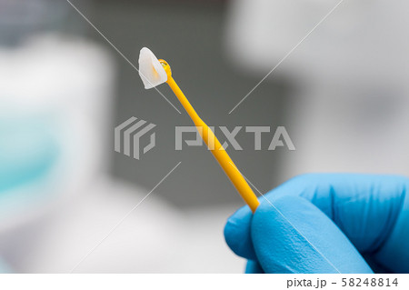 closeup ceramic veneer on a stick in a dentist 58248814