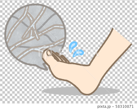 水虫 菌がいる 水虫 菌がいる 58310871