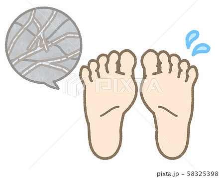 水虫 足の裏 両足 水虫 足の裏 両足 58325398