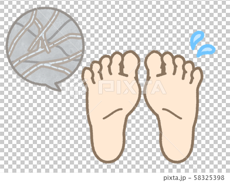 水虫 足の裏 両足 水虫 足の裏 両足 58325398