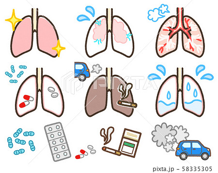 肺のトラブルいろいろのイラスト素材