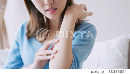 woman has dry skin woman has dry skin 58386894