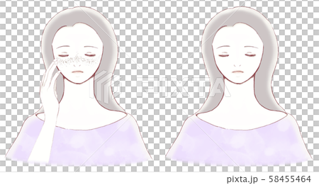 Before and after comparison of a woman's face with freckles and a woman without freckles 58455464