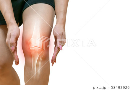 Human leg Osteoarthritis inflammation Of bone joints 58492926