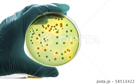 Gloved hand holding a Petri dish Bacteria culture Gloved hand holding a Petri dish Bacteria culture 58513422