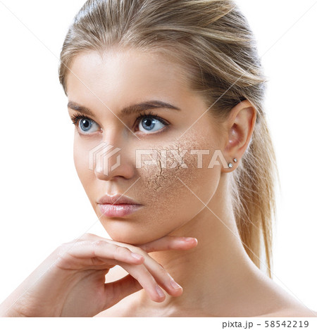 Young woman with dehydrated skin. Young woman with dehydrated skin. 58542219