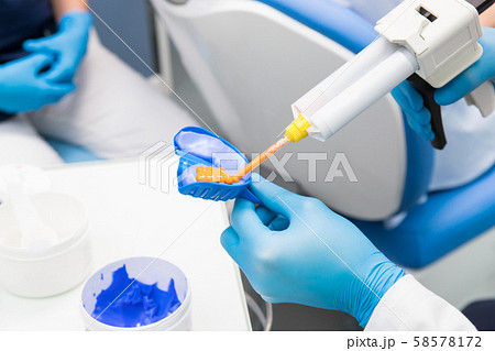 Dentist prepares material for a mold of teeth. Dentist prepares material for a mold of teeth. 58578172