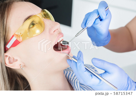A close-up of the girl's face is examined by a dental examiner with his mouth open and a napkin and A close-up of the girl's face is examined by a dental examiner with his mouth open and a napkin and 58715347