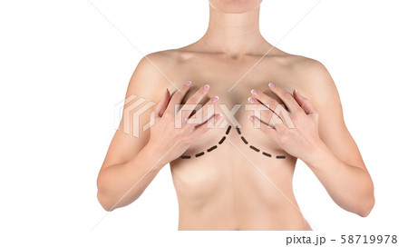 Female breasts marked for plastic operation, isolated on white. Woman cover her bust by her hands. Female breasts marked for plastic operation, isolated on white. Woman cover her bust by her hands. 58719978