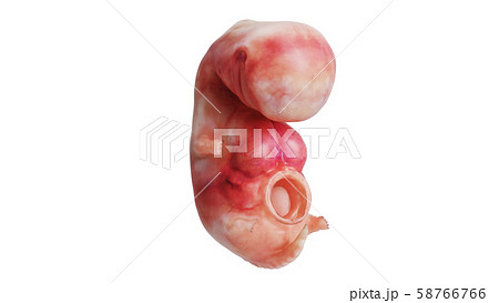 Human embryo fetus unborn 58766766