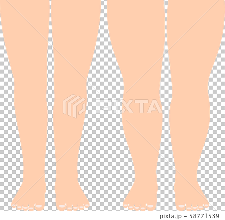 肥腿和標準腿 肥腿和標準腿 58771539