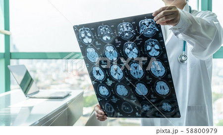 Brain disease diagnosis with medical doctor seeing Magnetic Resonance Imaging (MRI) film diagnosing elderly ageing patient neurodegenerative illness problem for neurological medical treatment 58800979