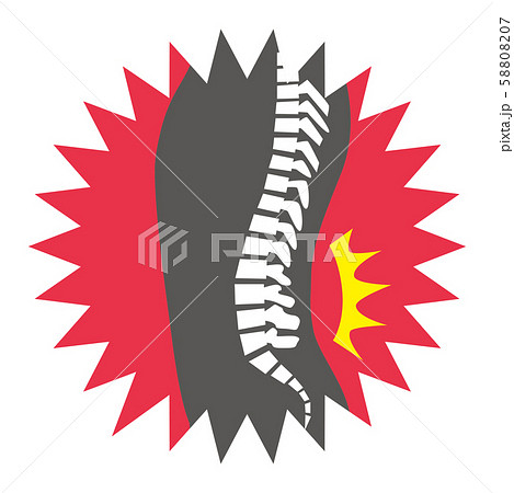 腰痛 ぎっくり腰 男性 背骨 腰のイラスト素材 5007