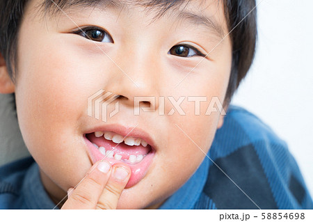 歯が抜けた男の子 歯が抜けた男の子 58854698