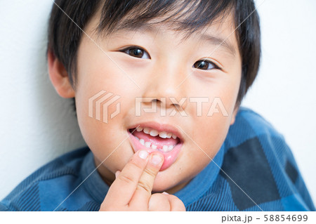 歯が抜けた男の子 歯が抜けた男の子 58854699