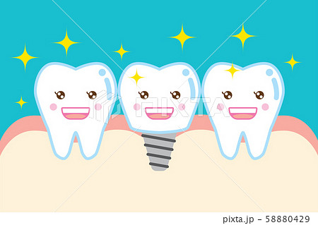 インプラントのかわいい歯のイラスト Cute Cartoon Implant Toothのイラスト素材