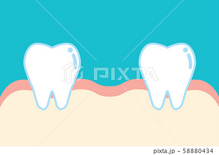 抜歯した歯のイラスト Illustration Of Removal Of Toothのイラスト素材