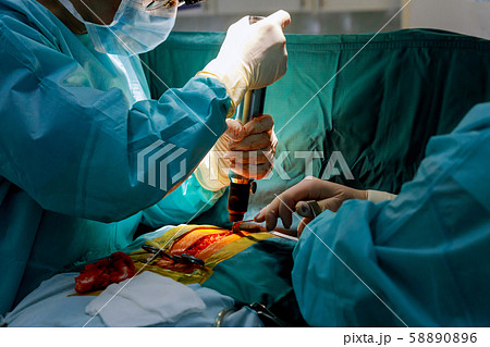 Preparation the surgical operation with a cut in Preparation the surgical operation with a cut in 58890896
