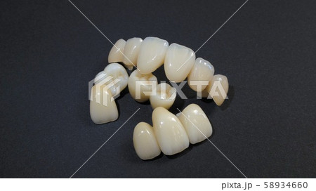 きれいな歯、好きですか 58934660