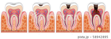 A Set of Human Tooth 58942895