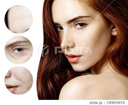 Zoom circle shows of aged skin of redhead woman before and after rejuvenation. 58964654