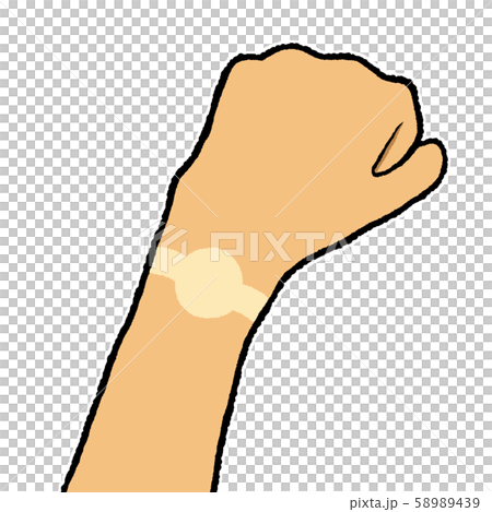 腕　日焼け 58989439