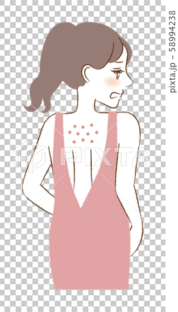 背中 ニキビ スキンケア 女性 イラスト 肌 背中 ニキビ スキンケア 女性 イラスト 肌 58994238