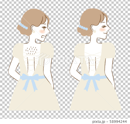 背中　脱毛　ムダ毛　スキンケア　エステサロン　ビフォーアフター　イラスト 58994244