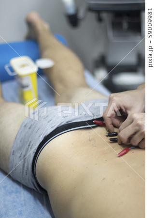 EPI dry needling physiotherapy 59009981