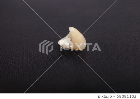入れ歯，仮歯 59091102