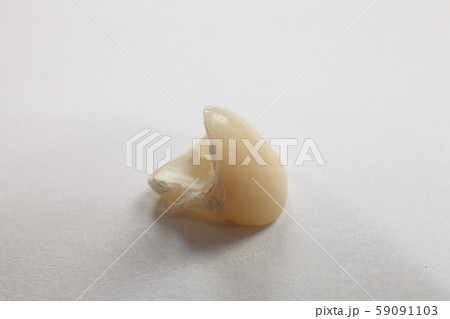 入れ歯,仮歯 入れ歯,仮歯 59091103