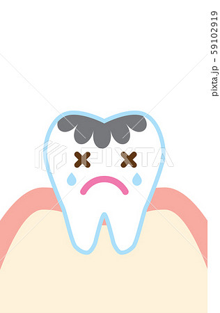 虫歯のかわいい歯のイラスト Cute Cartoon Decayed Tooth Illustratのイラスト素材