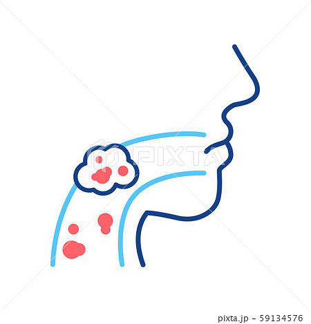 Laryngeal cancer line color icon. Human organ concept. Malignant neoplasm. Sign for web page, mobile 59134576