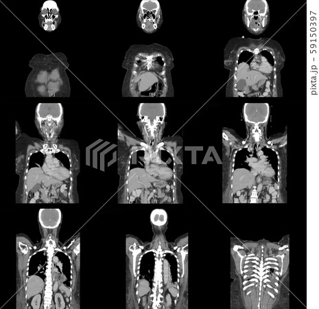 x-ray image mri scan x-ray image mri scan 59150397