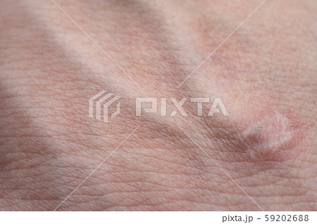 Photo of woman's hand with veins, closeup photo 59202688