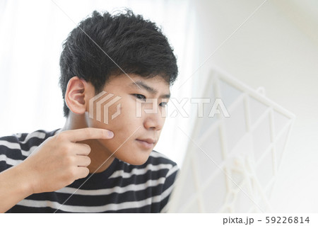 男子学生　ニキビ　肌トラブル 59226814